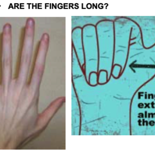 060_01 Long fingers